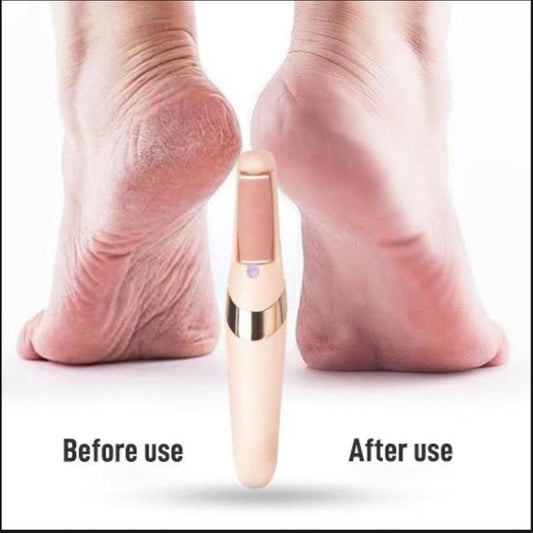 Electric Foot Callus Remover & Pedicure